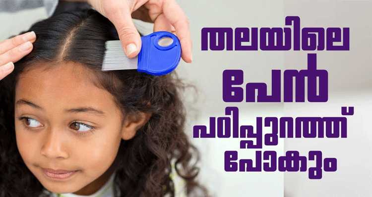 remedies-for-head-lice