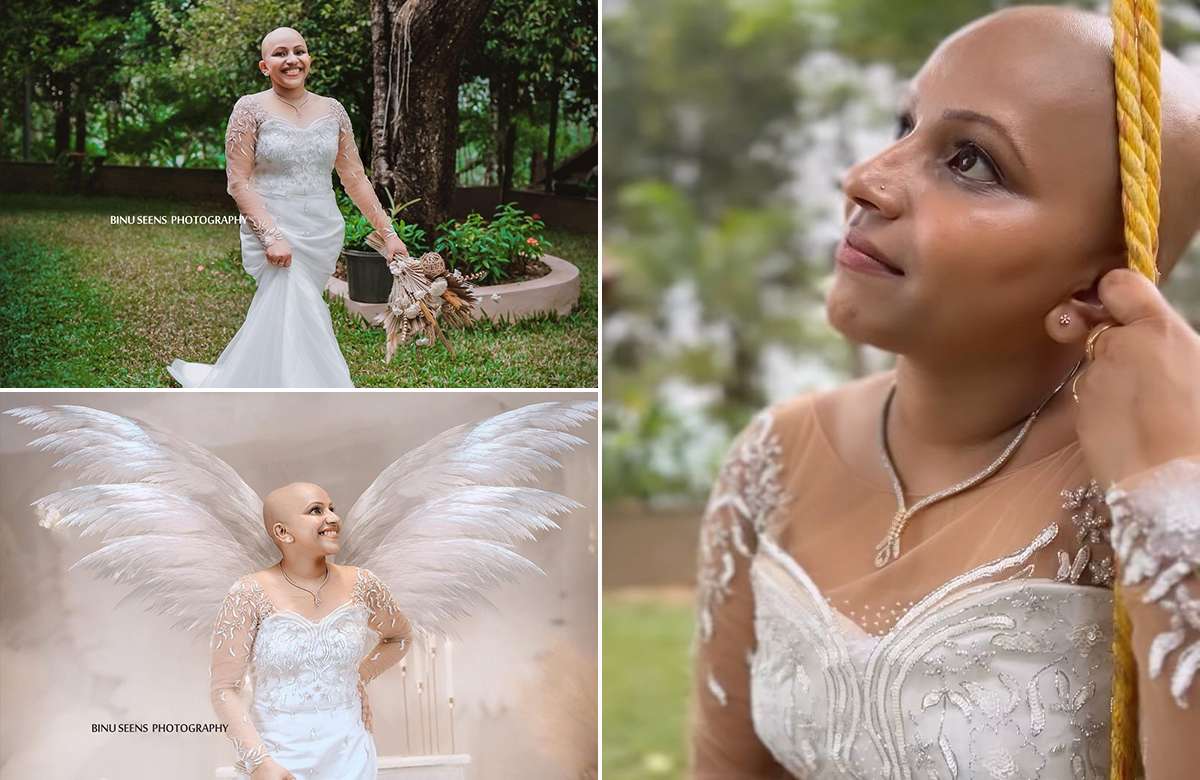 Cancer Survivor Steffy Thomas Wedding Photoshoot Viral